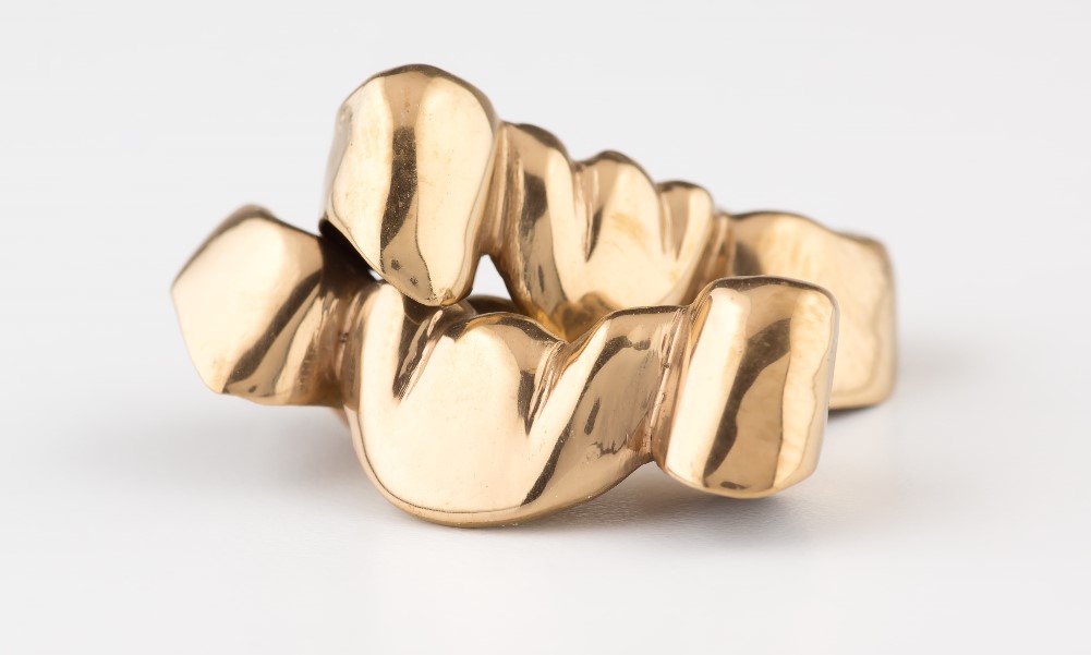 Zahngold Ankauf - Online Zahngold verkaufen zu hohen Zahngoldpreisen